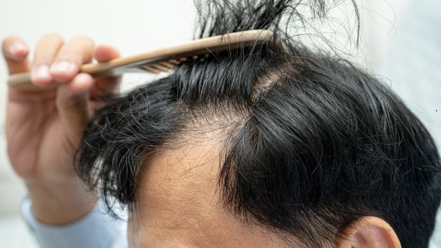 बाल झड़ने से हैं परेशान? ये 5 घरेलू उपाय दिलाएंगे राहत